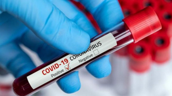 سوسة: تسجيل أعلى عدد وفيات بفيروس كورونا و90 إصابة جديدة‎